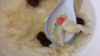 百合花的功效与作用 都说吃“百合”益处多!它的这些好处你了解吗?