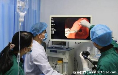 肠镜有什么风险?引发心肌梗死